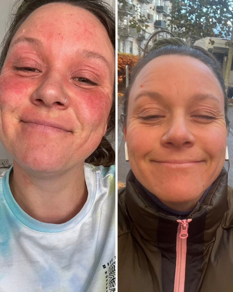 Klient før og efter