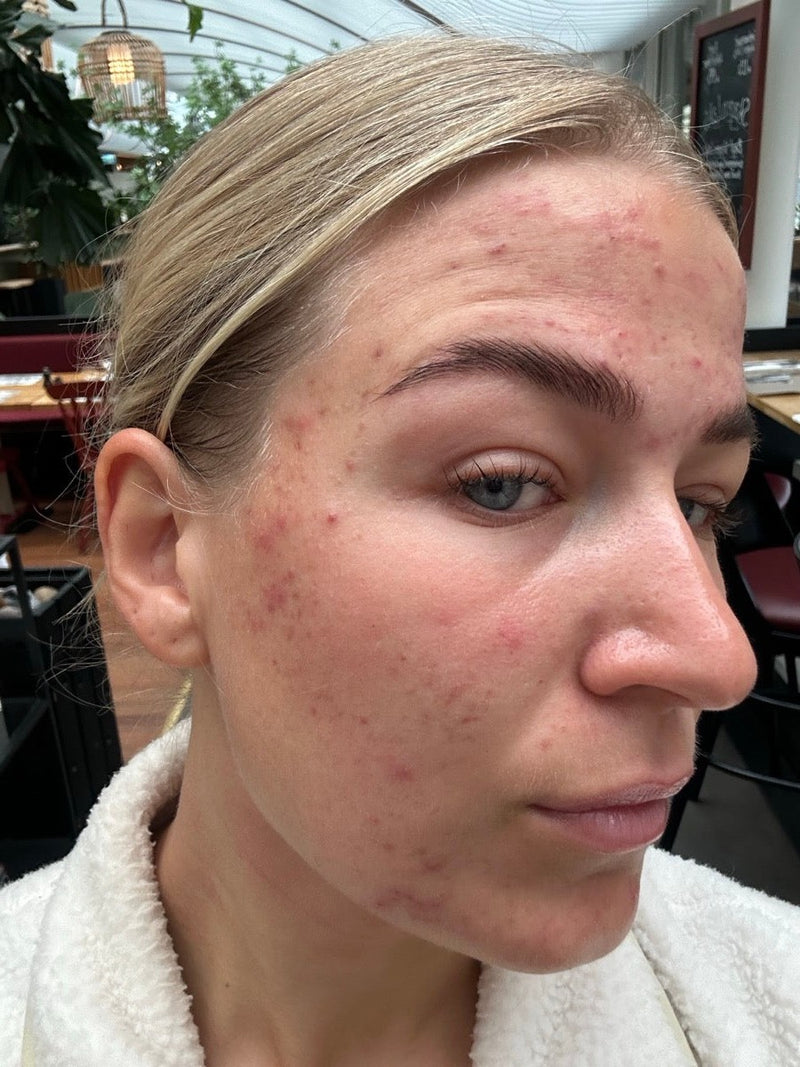 Line, grundlægger af Derma Habits