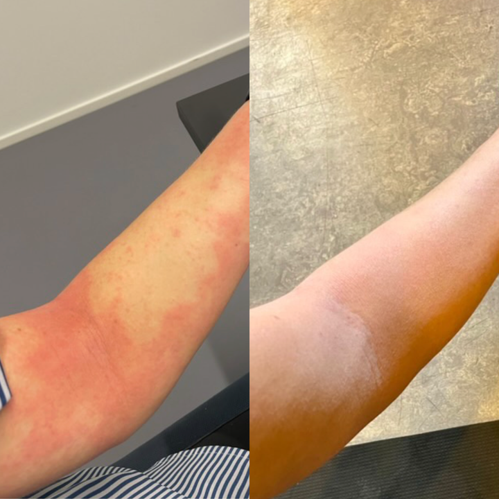Før/efter