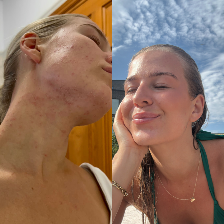 Før/efter