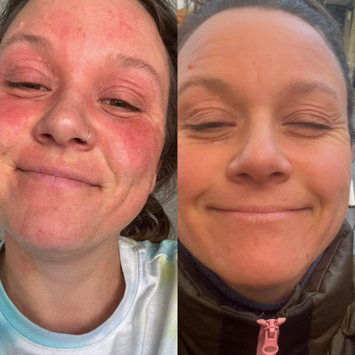 Før/efter