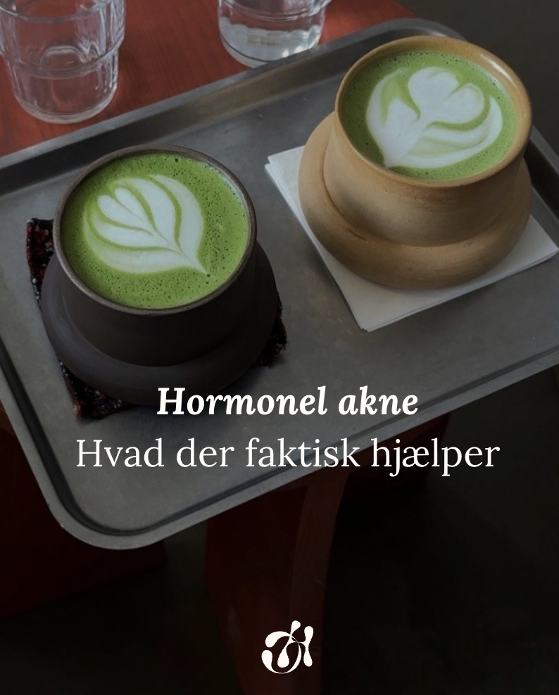 Hormonel akne; hvad der faktisk hjælper