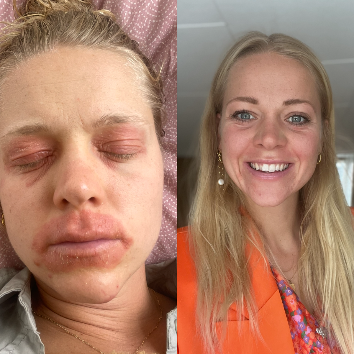 Efter: Sarah, 8 uger