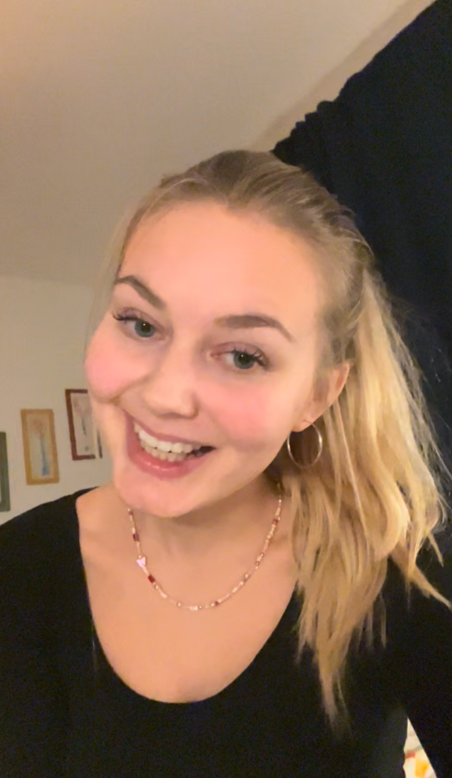 Iben's oplevelse med akneforløbet