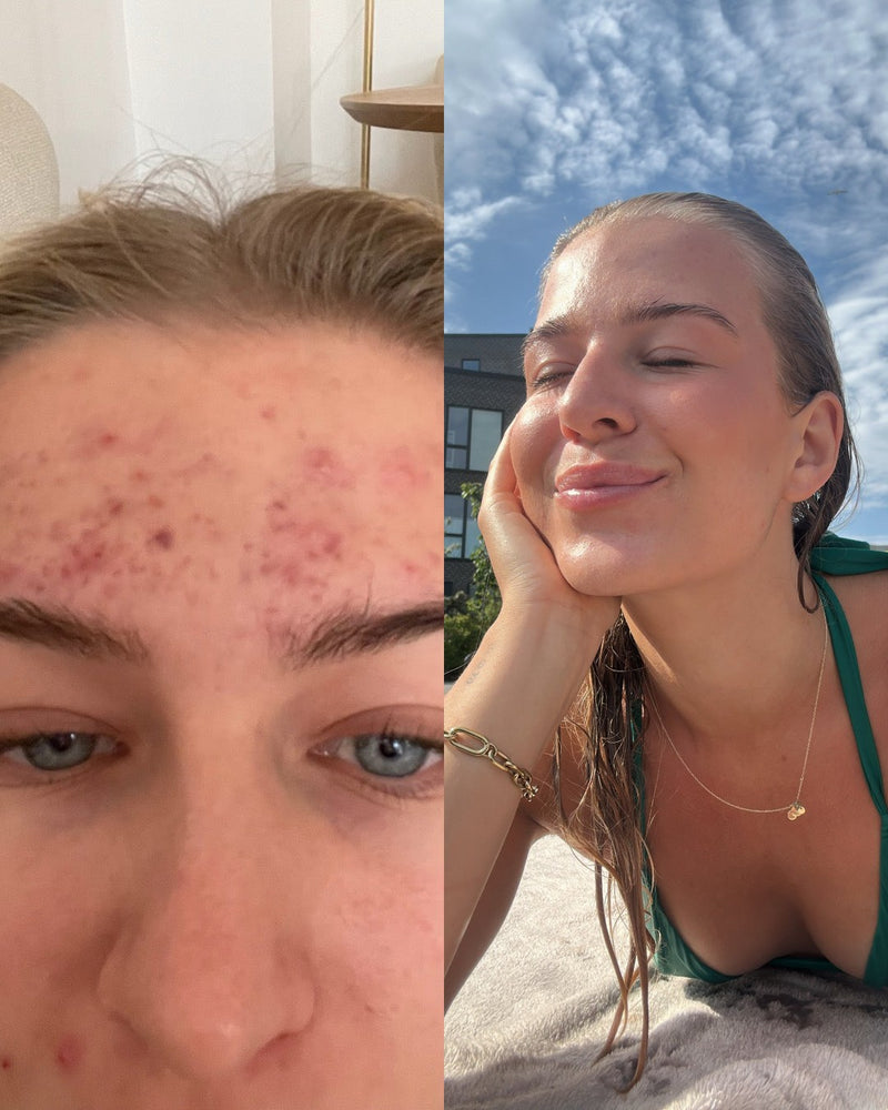 Før og efter